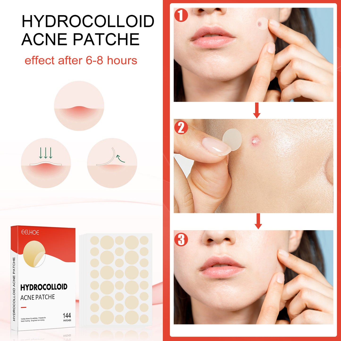 EELHOE Hydrocolloid Acne Patch – Invisible Spot Treatment for Blemish-Free Skin - SmartPlaceShop