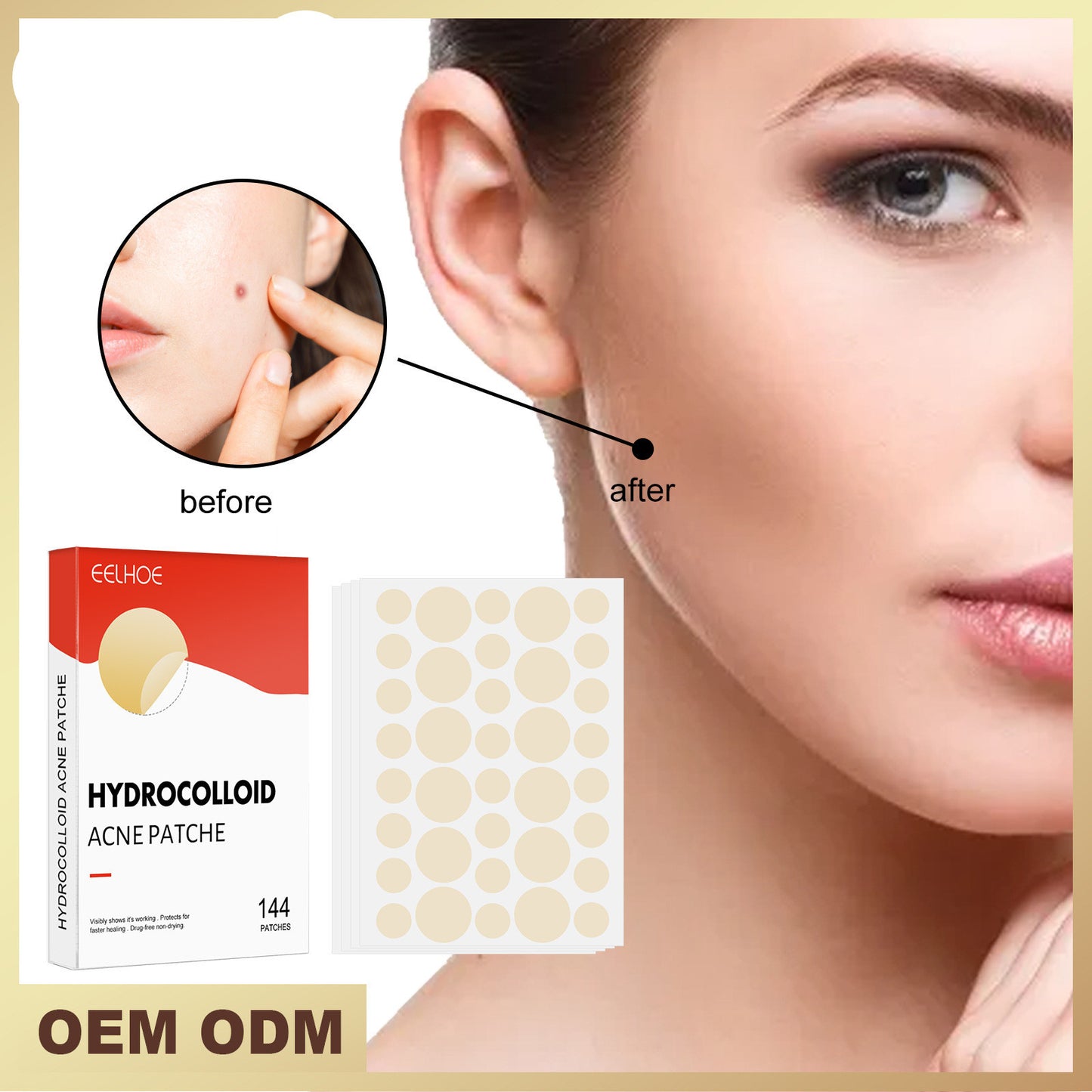 EELHOE Hydrocolloid Acne Patch – Invisible Spot Treatment for Blemish-Free Skin - SmartPlaceShop