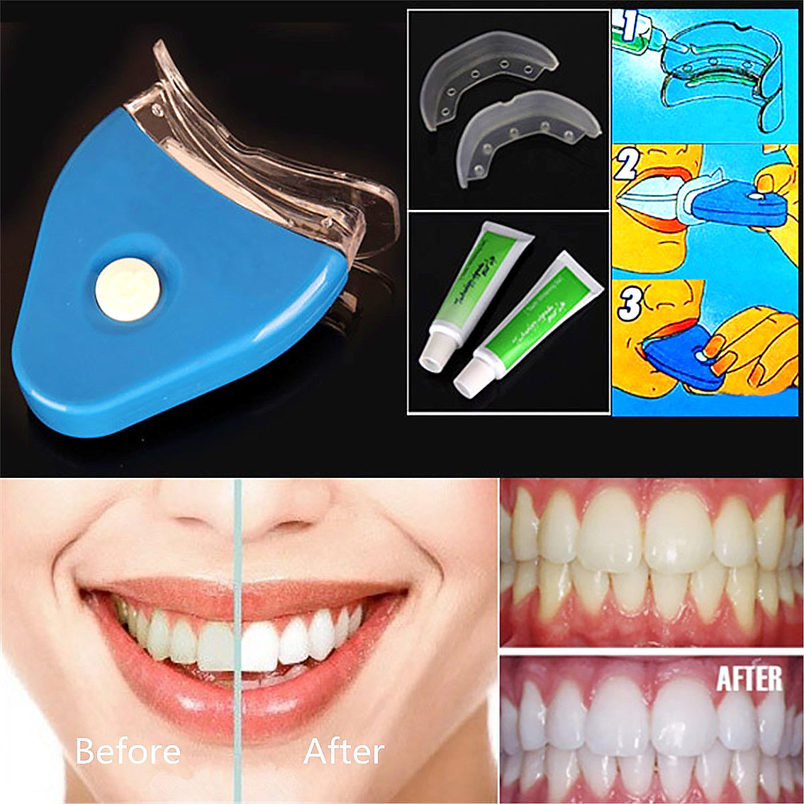 🦷 Oral Gel Teeth Whitening LED Kit – Bright Smile at Home - SmartPlaceShop