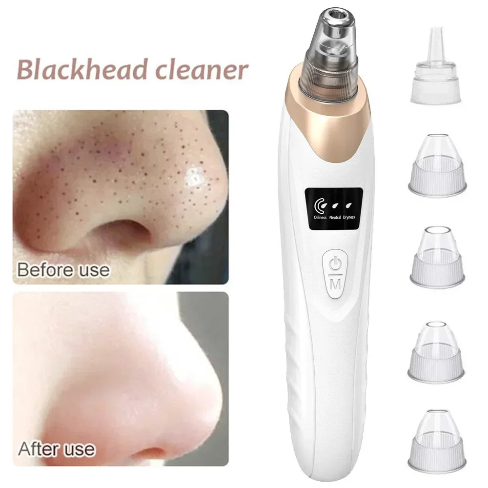 USB Rechargeable Blackhead Remover Vacuum – Deep Pore Cleaner with 5 Suction Heads for Acne & Comedone Extraction - SmartPlaceShop