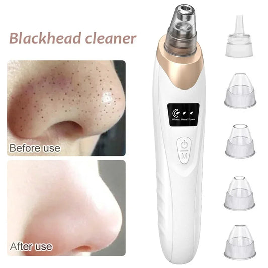 USB Rechargeable Blackhead Remover Vacuum – Deep Pore Cleaner with 5 Suction Heads for Acne & Comedone Extraction - SmartPlaceShop
