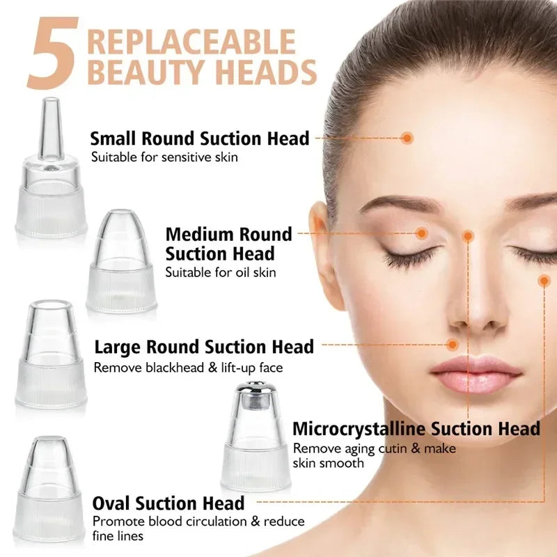 USB Rechargeable Blackhead Remover Vacuum – Deep Pore Cleaner with 5 Suction Heads for Acne & Comedone Extraction - SmartPlaceShop