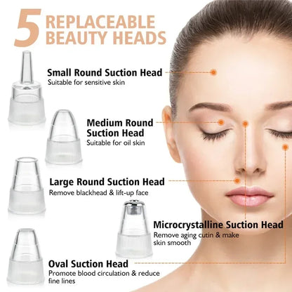 USB Rechargeable Blackhead Remover Vacuum – Deep Pore Cleaner with 5 Suction Heads for Acne & Comedone Extraction - SmartPlaceShop