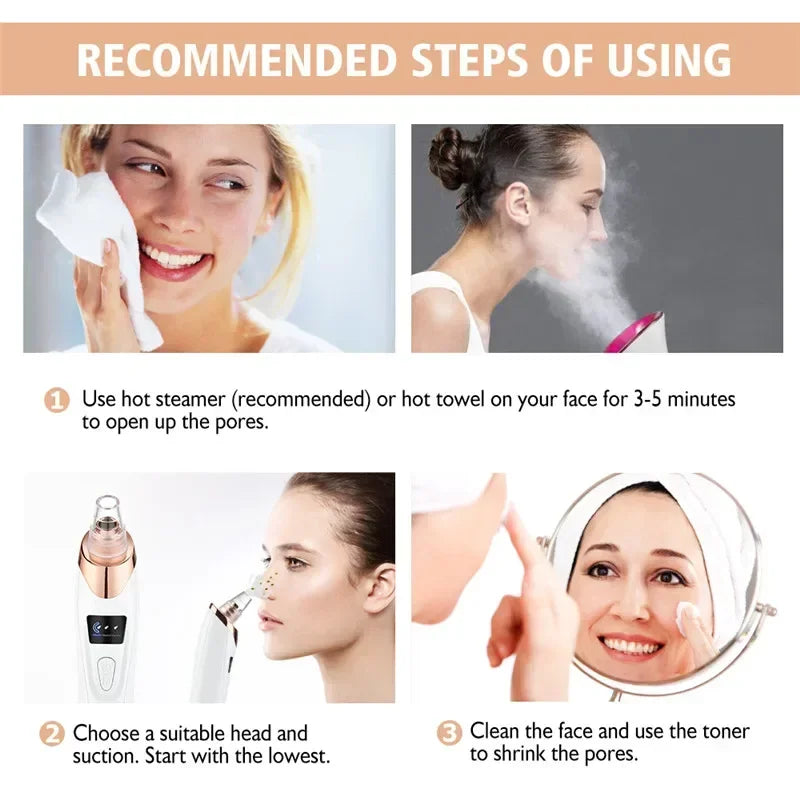USB Rechargeable Blackhead Remover Vacuum – Deep Pore Cleaner with 5 Suction Heads for Acne & Comedone Extraction - SmartPlaceShop