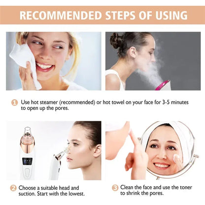 USB Rechargeable Blackhead Remover Vacuum – Deep Pore Cleaner with 5 Suction Heads for Acne & Comedone Extraction - SmartPlaceShop
