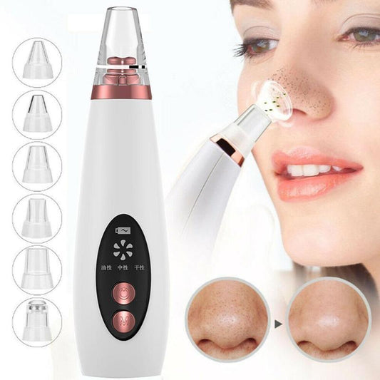 Deep Clean Pore Vacuum – Acne & Blackhead Remover Tool - SmartPlaceShop